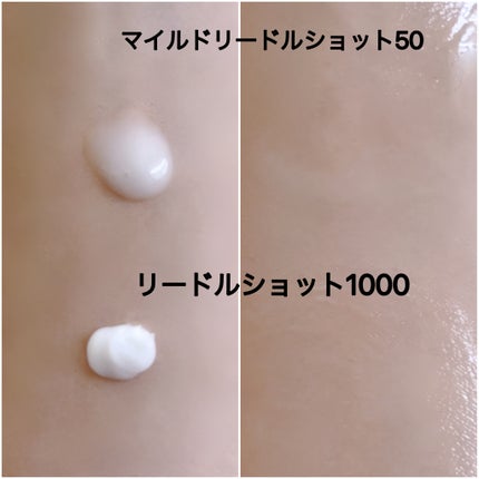 マイルドリードルショット50/VT/美容液を使ったクチコミ(4枚目)