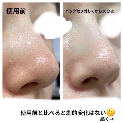 ノーモアブラックヘッド(ノーズピーリング)/One-day's you/スクラブ・ゴマージュを使ったクチコミ(4枚目)