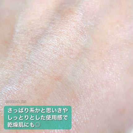 AZ アゼフィットスポッツ/NIKI PITA/フェイスクリームを使ったクチコミ(5枚目)