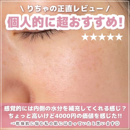 RMK Wトリートメント ローション/RMK/化粧水を使ったクチコミ(5枚目)