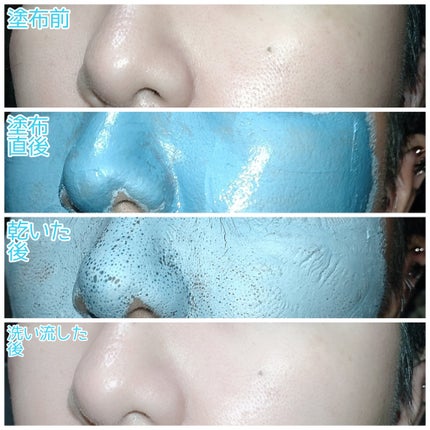ゼロ毛穴クレイパック/MEDICUBE/洗い流すパック・マスクを使ったクチコミ(8枚目)
