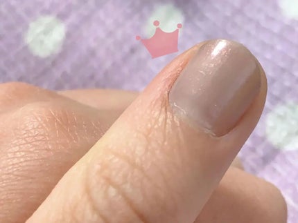 2-18(33094)バレイミスト