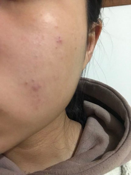 シカ メソッド クリーム/コジット/フェイスクリームを使ったクチコミ(2枚目)