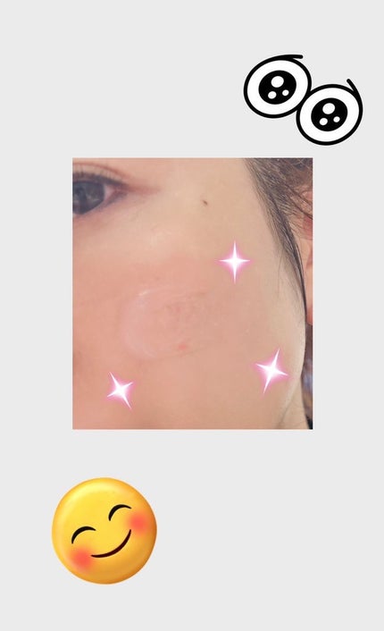 キングスベリービタナイトクリーム/hince/フェイスクリームを使ったクチコミ(5枚目)