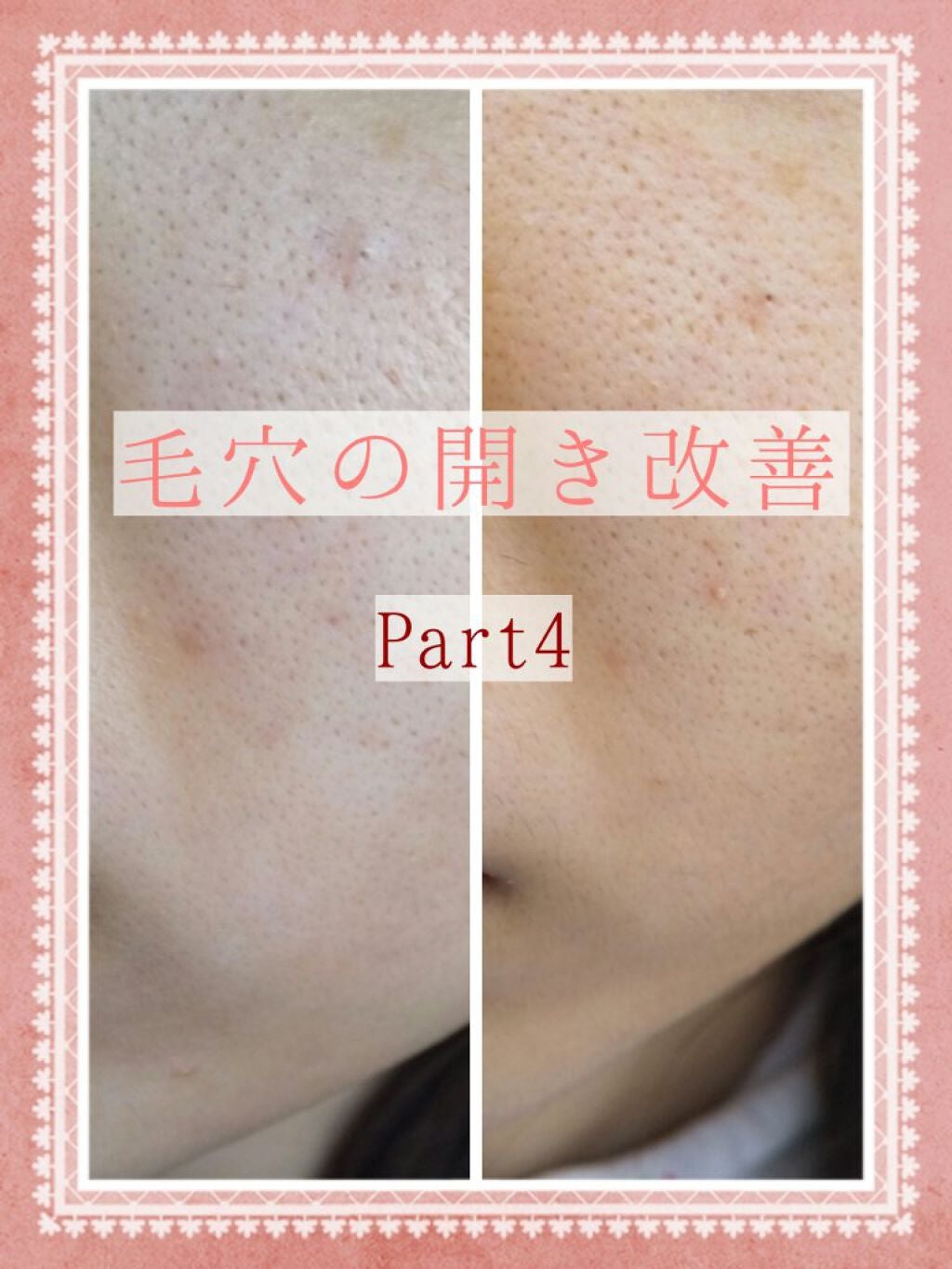 パワーマスク SP/ラッシュ/スクラブ・ゴマージュを使ったクチコミ(1枚目)