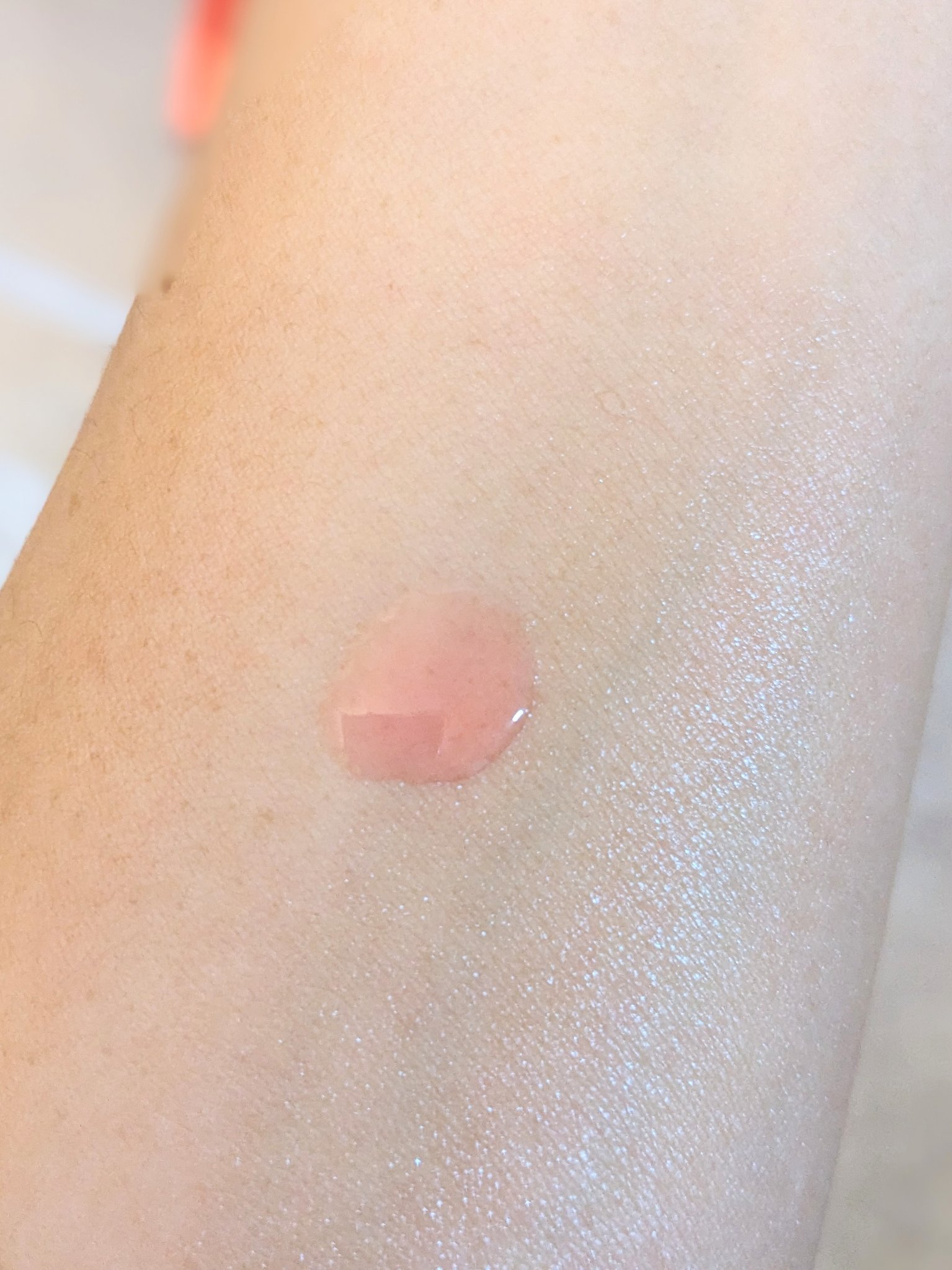 A1カーミング アンプル/VT/美容液を使ったクチコミ（2枚目）