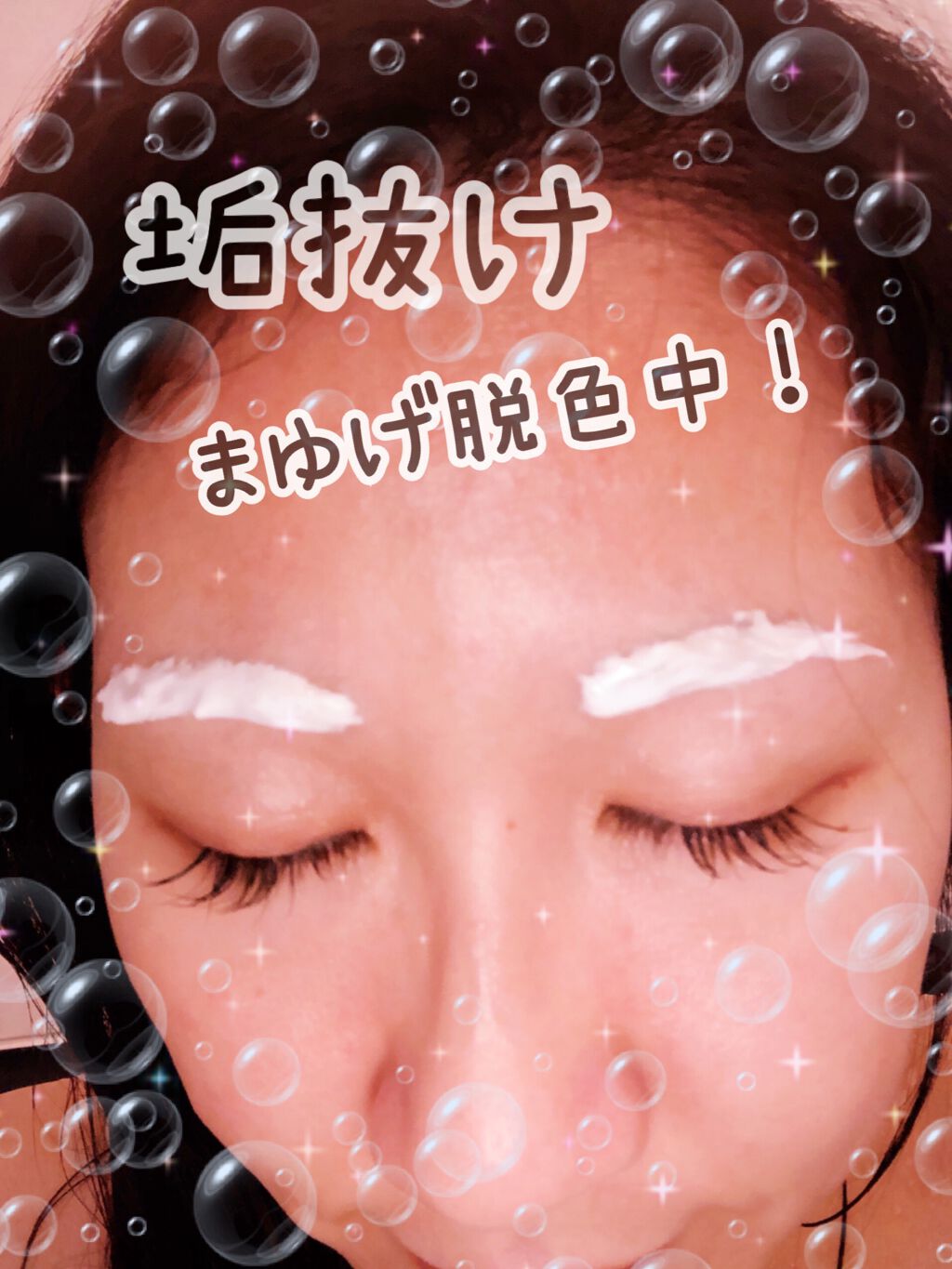 脱色クリーム スピーディー/エピラット/ムダ毛ケアを使ったクチコミ(3枚目)