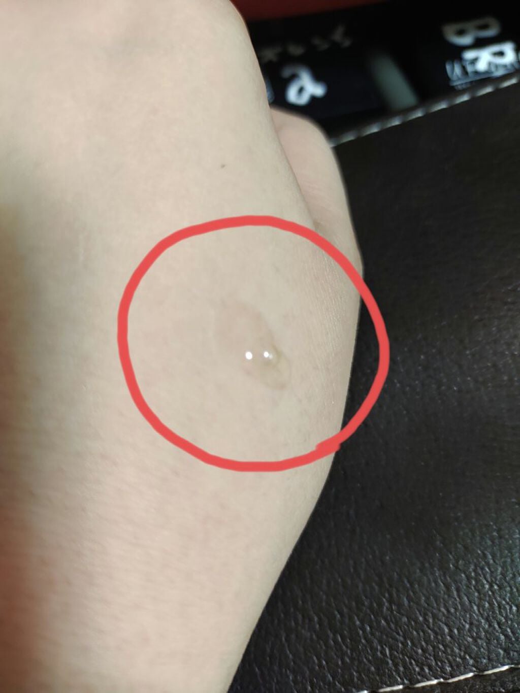 ドクダミ80%スージングアンプル/Anua/美容液を使ったクチコミ(4枚目)