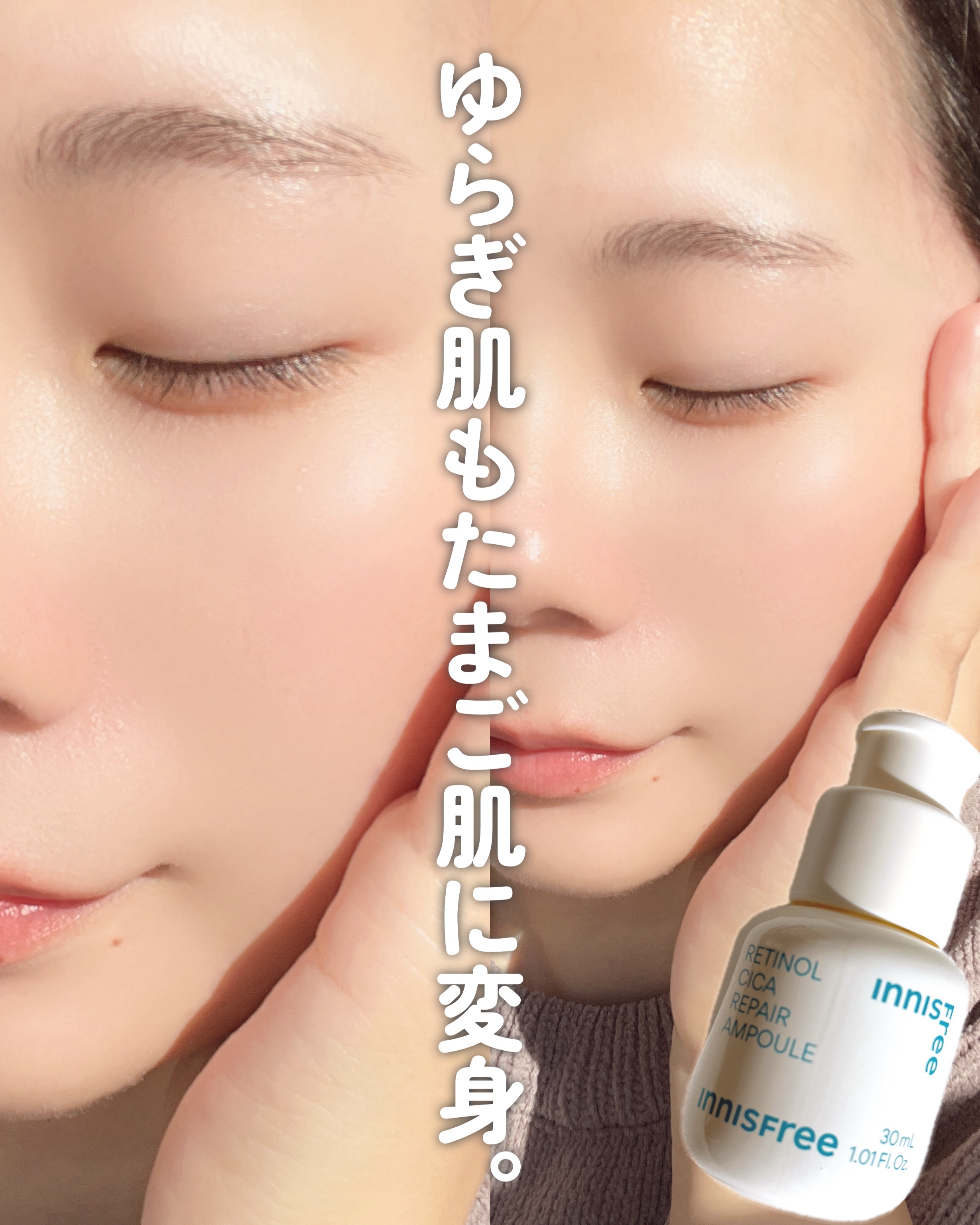 レチノール　シカ　リペア　セラム/innisfree/美容液を使ったクチコミ（1枚目）