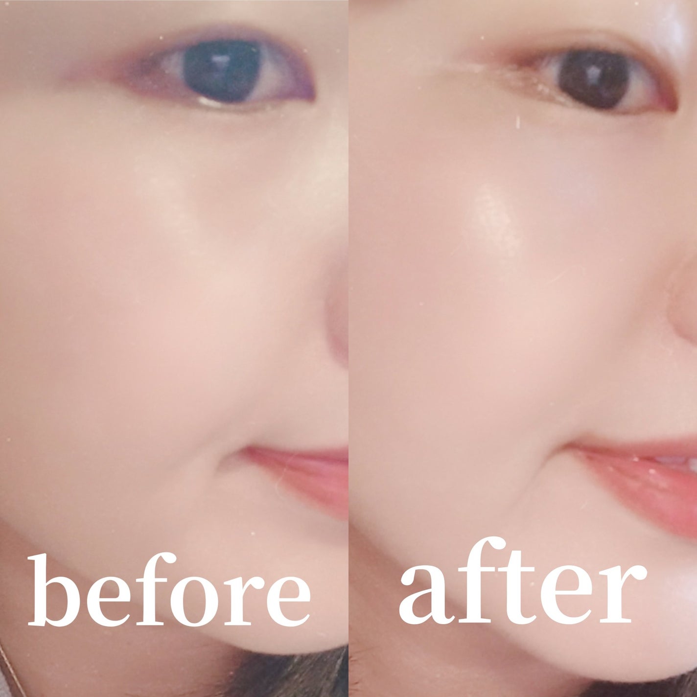 ベビー・アトクリーム/モンディエス/ボディクリームを使ったクチコミ(6枚目)