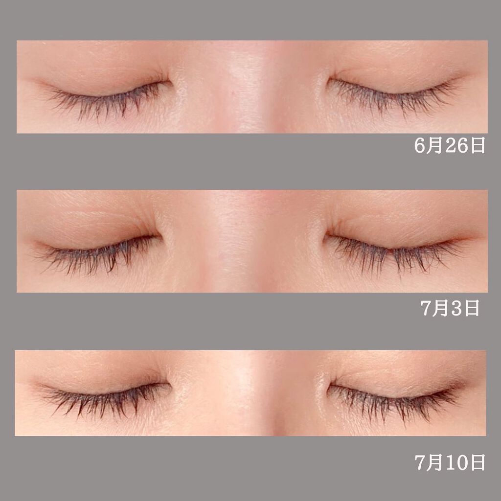 Long Lash Serum/BY ECOM/まつげ美容液を使ったクチコミ(5枚目)