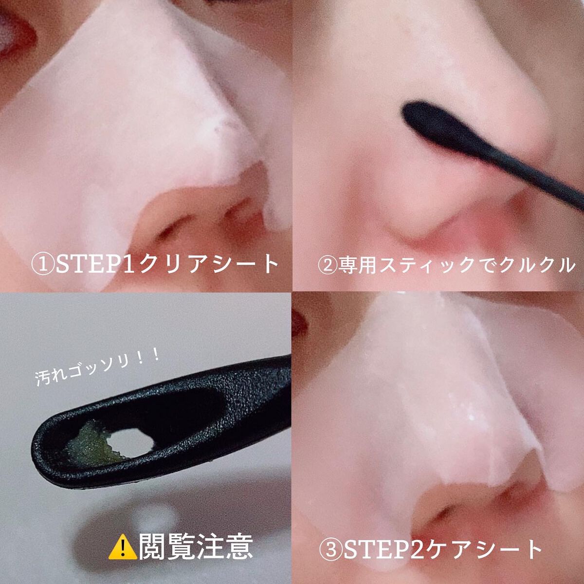 2STEP 鼻パック 女性用/anyism/その他スキンケアを使ったクチコミ（2枚目）