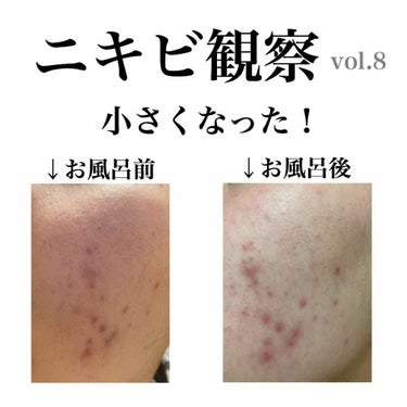 敏感肌用薬用美白美容液/無印良品/美容液を使ったクチコミ（1枚目）