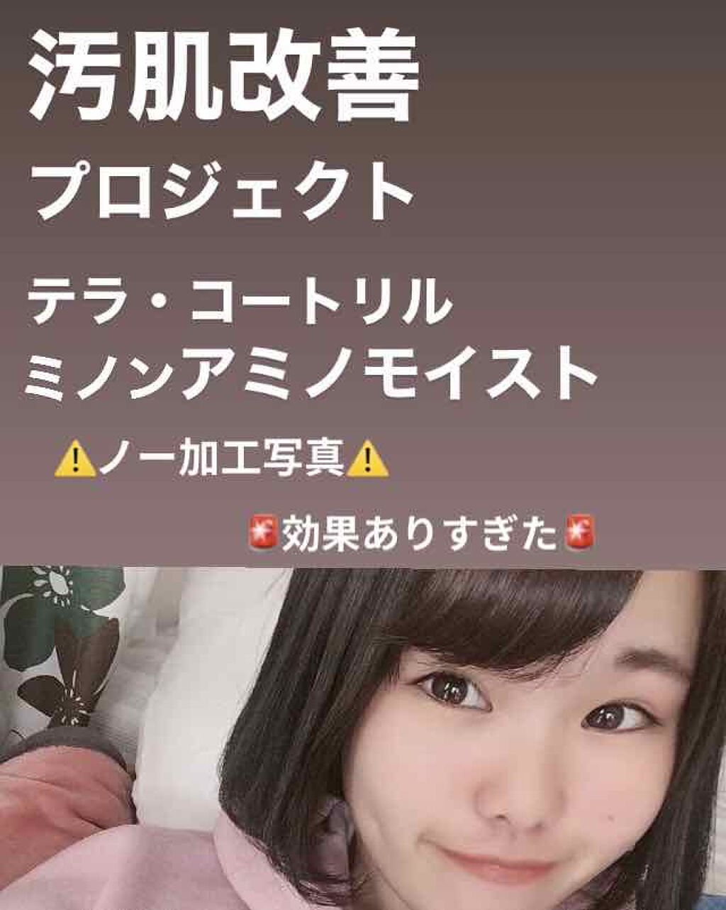 テラ・コートリル 軟膏(医薬品)/ジョンソン・エンド・ジョンソン/その他を使ったクチコミ(1枚目)
