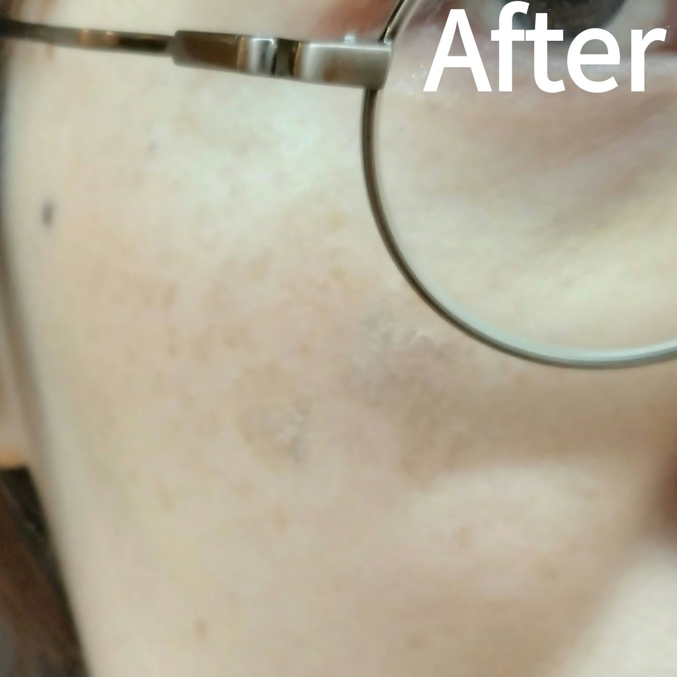 スポッツカバー ファウンデイション （コントロールカラー）C2/SHISEIDO/クリームコンシーラーを使ったクチコミ（3枚目）