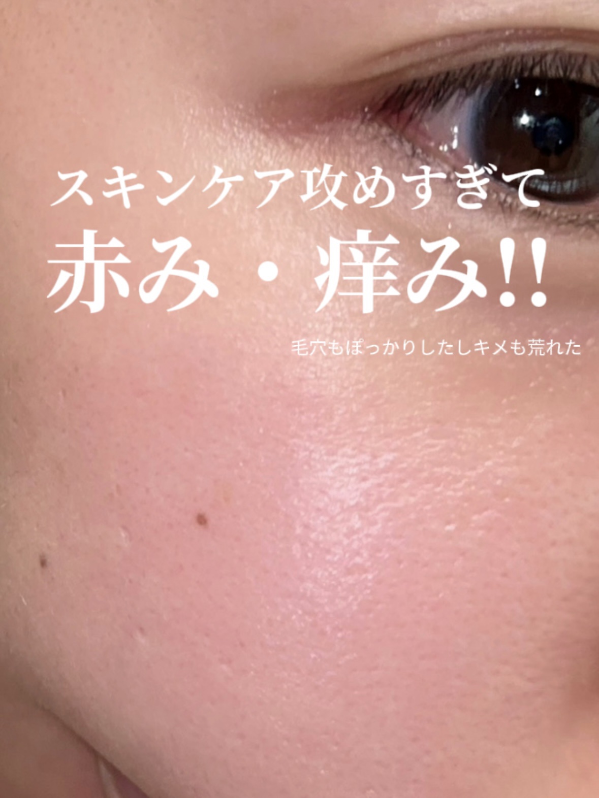 セラミエイド 薬用スキンミルク/セラミエイド/ボディミルクを使ったクチコミ（1枚目）