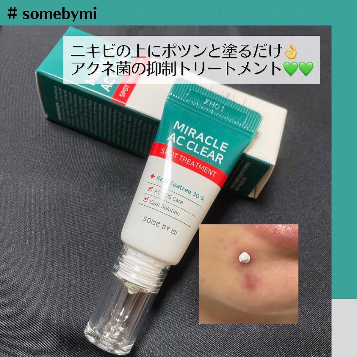 ミラクルアクネクリアスポットトリートメント/SOME BY MI/美容液を使ったクチコミ（1枚目）