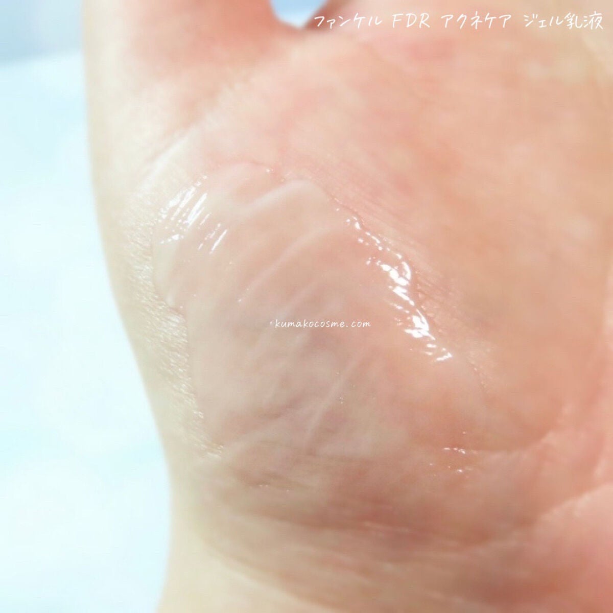 アクネケア ジェル乳液 <医薬部外品>/ファンケル/乳液を使ったクチコミ(5枚目)