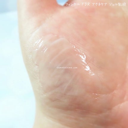 アクネケア ジェル乳液 <医薬部外品>/ファンケル/乳液を使ったクチコミ(5枚目)