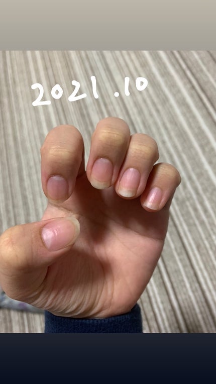 エテュセ クイックケアコート/ettusais/ネイルオイル・トリートメントを使ったクチコミ(7枚目)