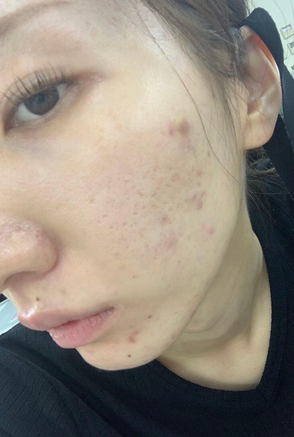 インテンシブ エキナセアクリーム/ARGITAL/フェイスクリームを使ったクチコミ(2枚目)