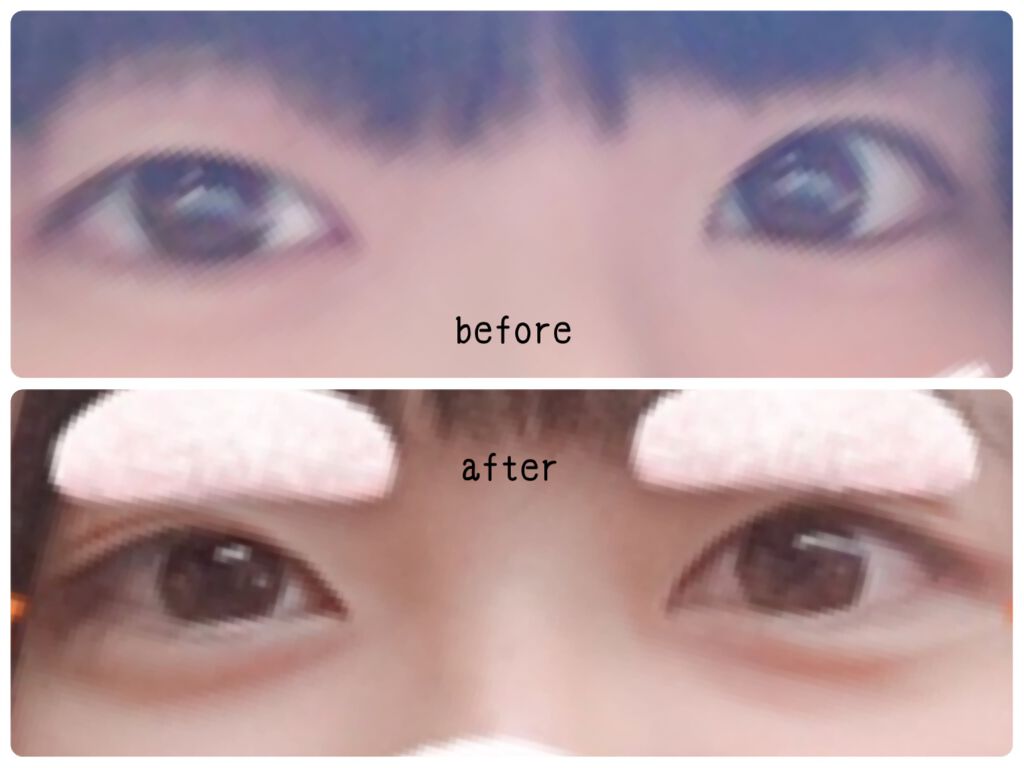 のびーるアイテープ（絆創膏タイプ、レギュラー）/DAISO/二重まぶた用アイテムを使ったクチコミ（2枚目）