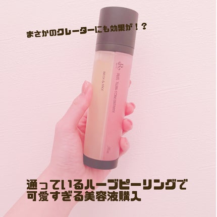 ルヴィ 陶肌ツインコンセントレート/ルヴィ/美容液を使ったクチコミ(1枚目)