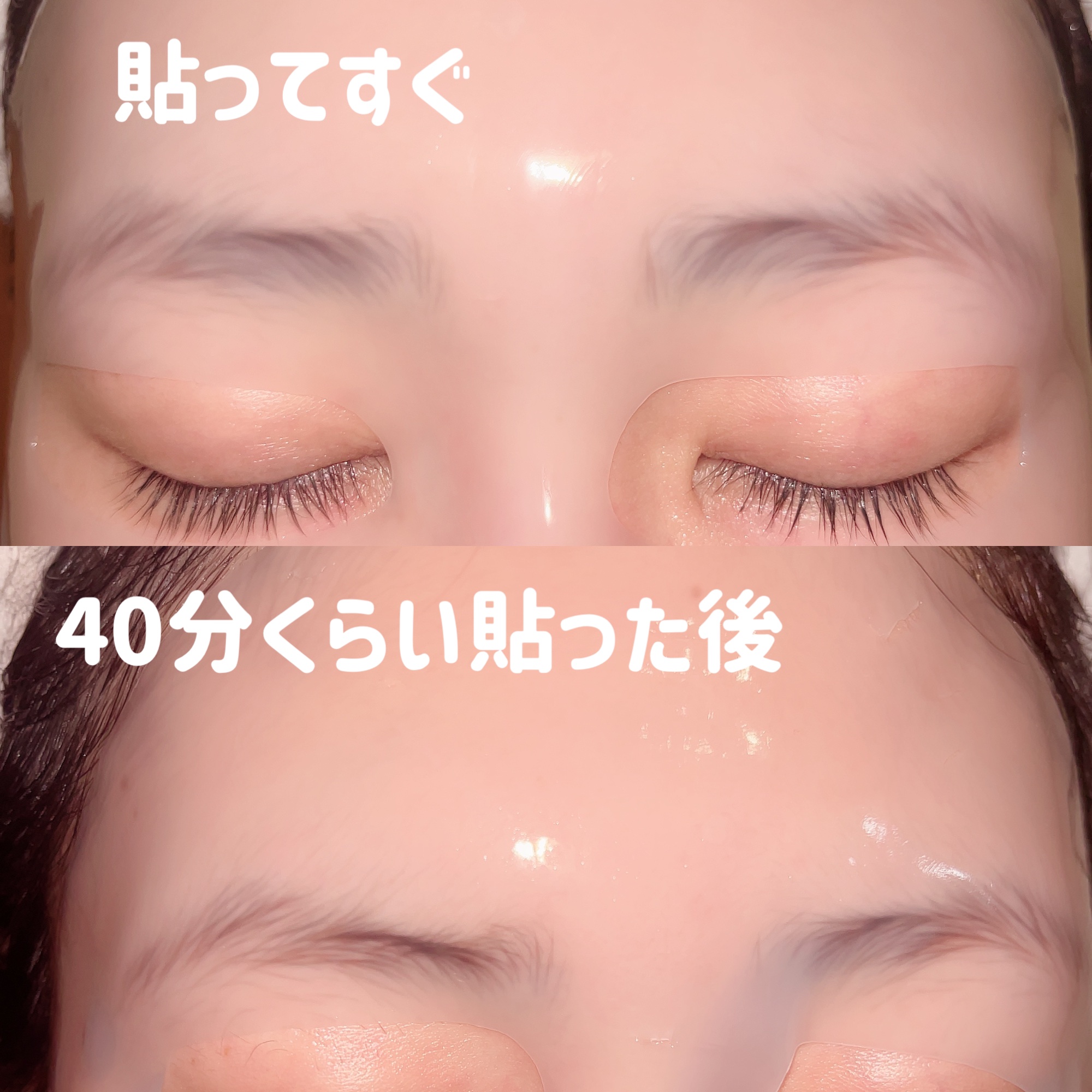 ブルーレイヤーウォータードームマスク/MEDITHERAPY/シートマスク・パックを使ったクチコミ（3枚目）