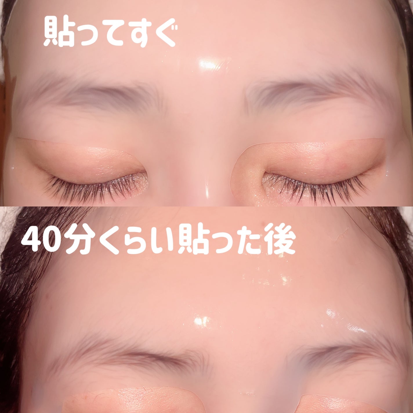 ブルーレイヤーウォータードームマスク/MEDITHERAPY/シートマスク・パックを使ったクチコミ(3枚目)