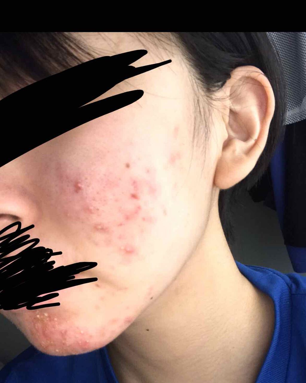 薬用しみ対策 美白化粧水/メラノCC/化粧水を使ったクチコミ（2枚目）