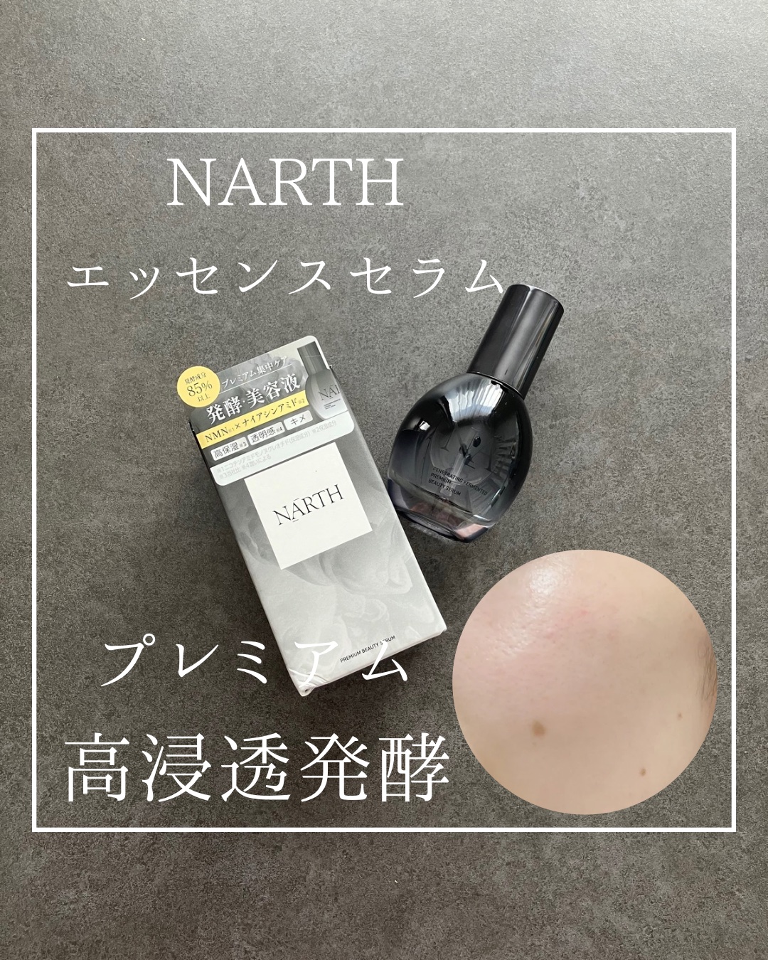 【新発売！】
NARTHの発酵美容液♡

こんにちは🌞
美容師歴10年以上のyuuです🕊️♡
以前、ヘアケアで大注目のNARTHのシャンプーとトリートメントのレビューをさせていただきました🙃！
今回、NARTHのスキンケアである発酵美