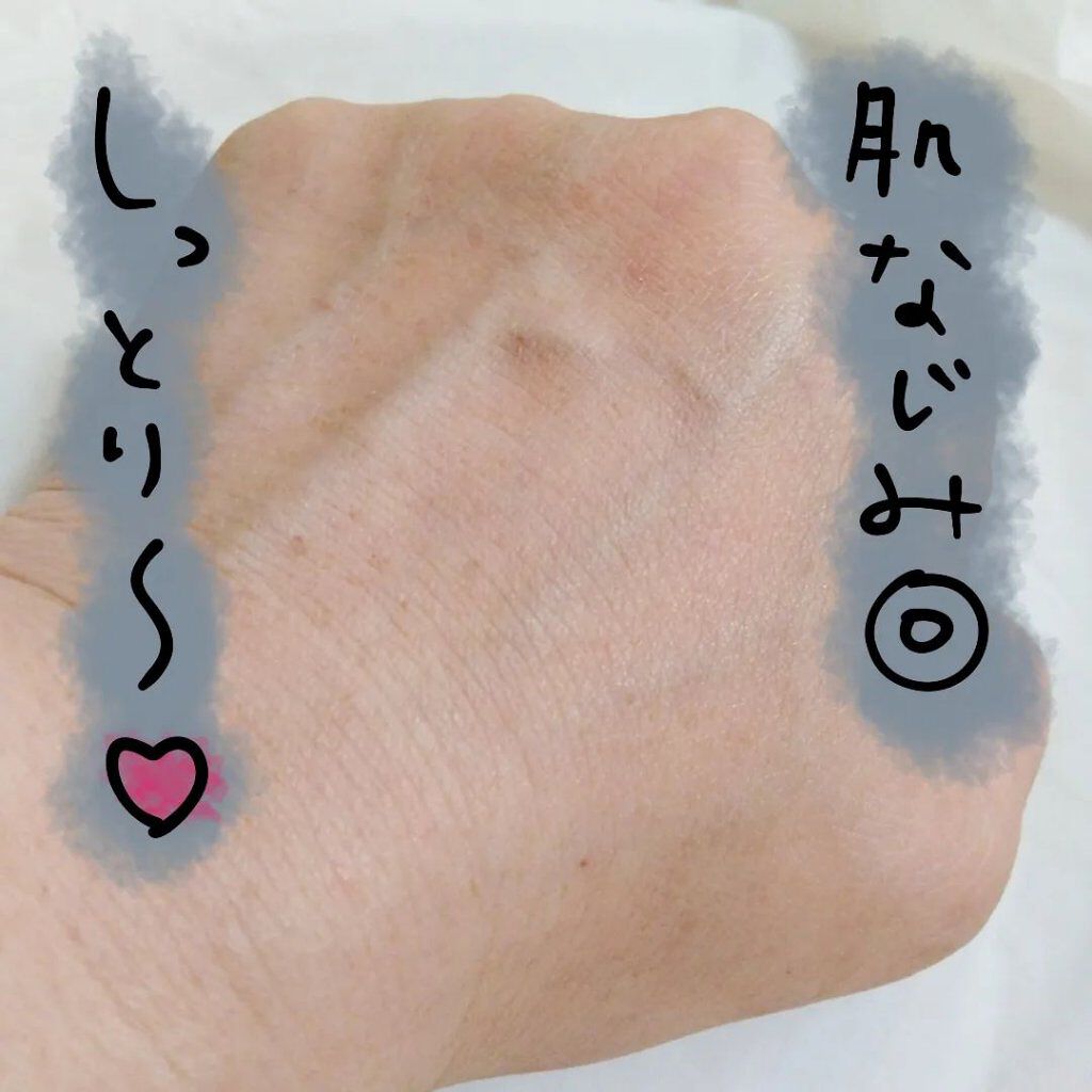 シラカバ 70% 水分ブースティングトナー/Anua/化粧水を使ったクチコミ（3枚目）