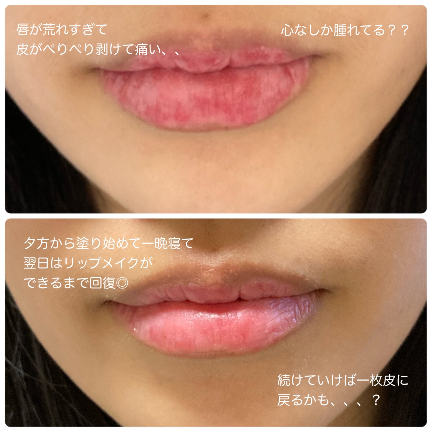 薬用メディカルリップスティックCn/メンターム/リップクリームを使ったクチコミ(3枚目)