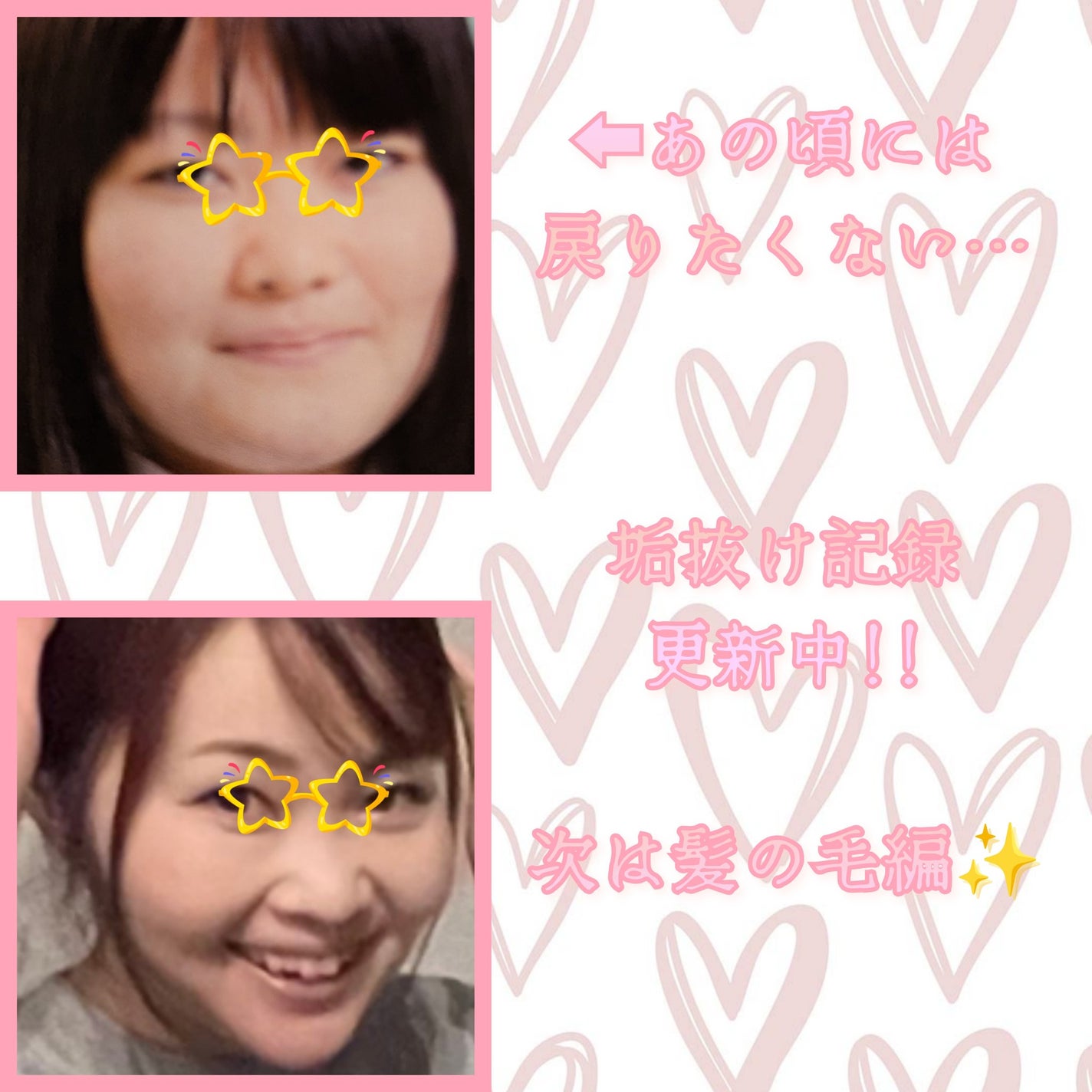 ひっかけられるトリートメントコーム/セリア/その他スタイリングを使ったクチコミ(1枚目)