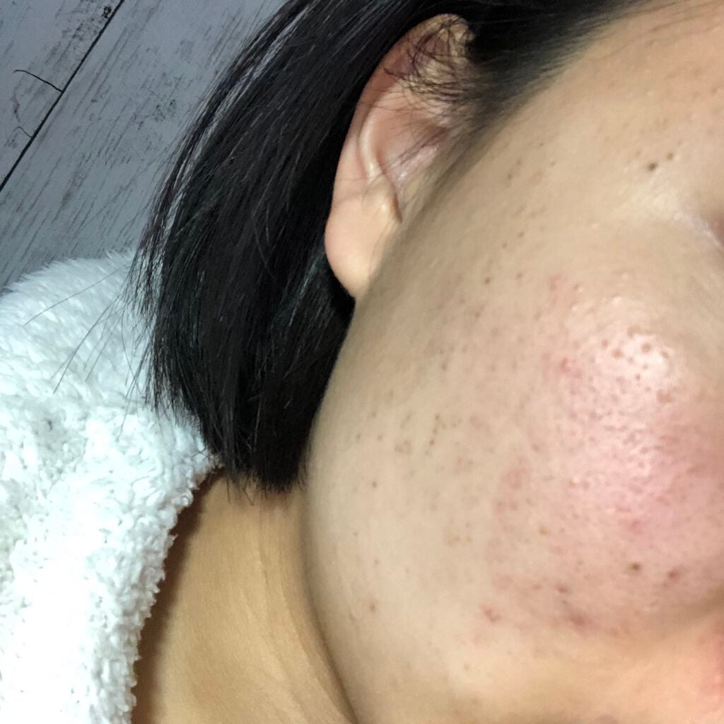 化粧水・敏感肌用・高保湿タイプ/無印良品/化粧水を使ったクチコミ(2枚目)