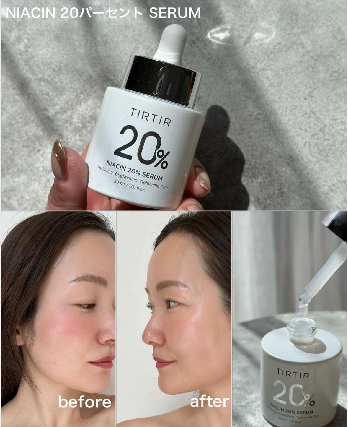 NIACIN 20% セラム/TIRTIR(ティルティル)/美容液を使ったクチコミ(2枚目)