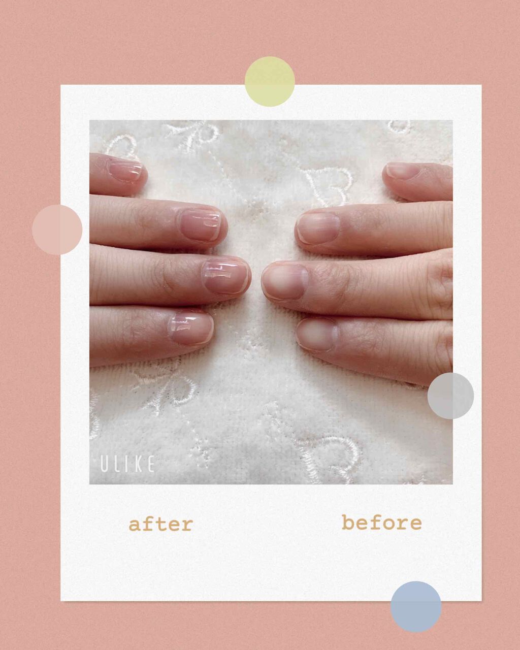 ネイルサポート ピンク/ネイルネイル/ネイルベースコートを使ったクチコミ（2枚目）