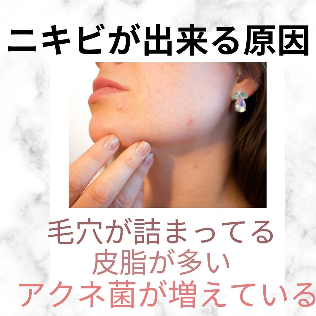 chinami♡美容好きな管理栄養士/福岡 on LIPS 「@biyoukanrieiyoushi繰り返すニキビ肌の方、絶..」(3枚目)