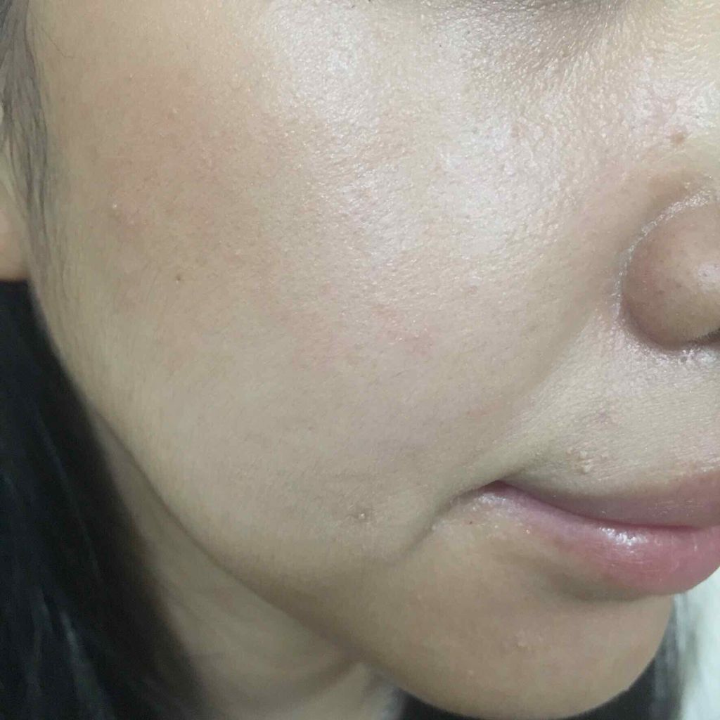 サエル ホワイトニング クリーム コンセントレート/DECENCIA/フェイスクリームを使ったクチコミ(3枚目)