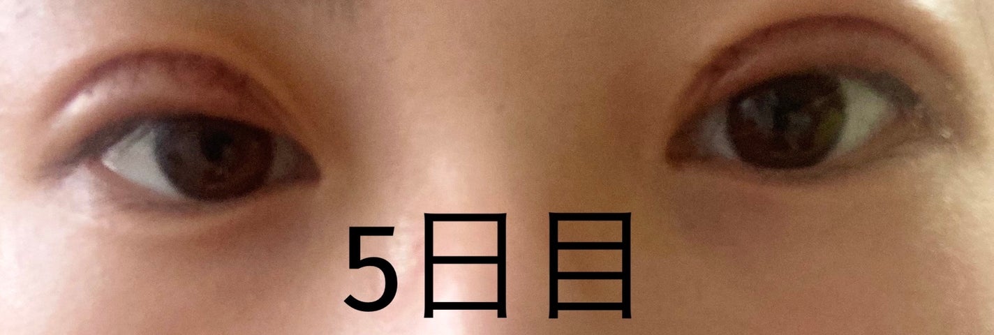 ãããœãð¡ãã©ãã100 on LIPS ãâïžäºéåéã¬ããããŠã³ã¿ã€ã ã5æ¥ç®è
«ãâæšæ¥ãšãããŸãå€ã..ãïŒ2æç®ïŒ