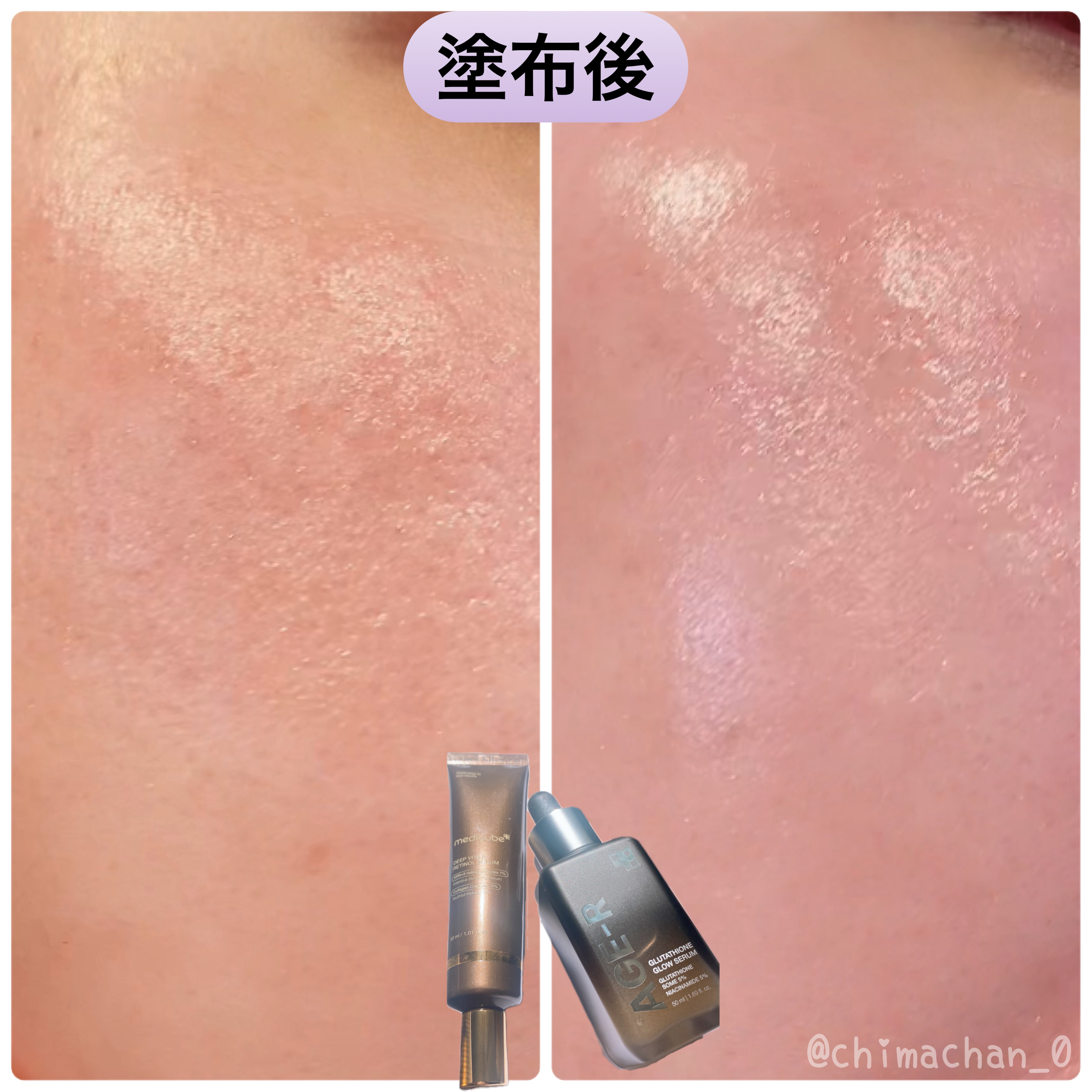 グルタチオングロウアンプル/MEDICUBE/美容液を使ったクチコミ（3枚目）
