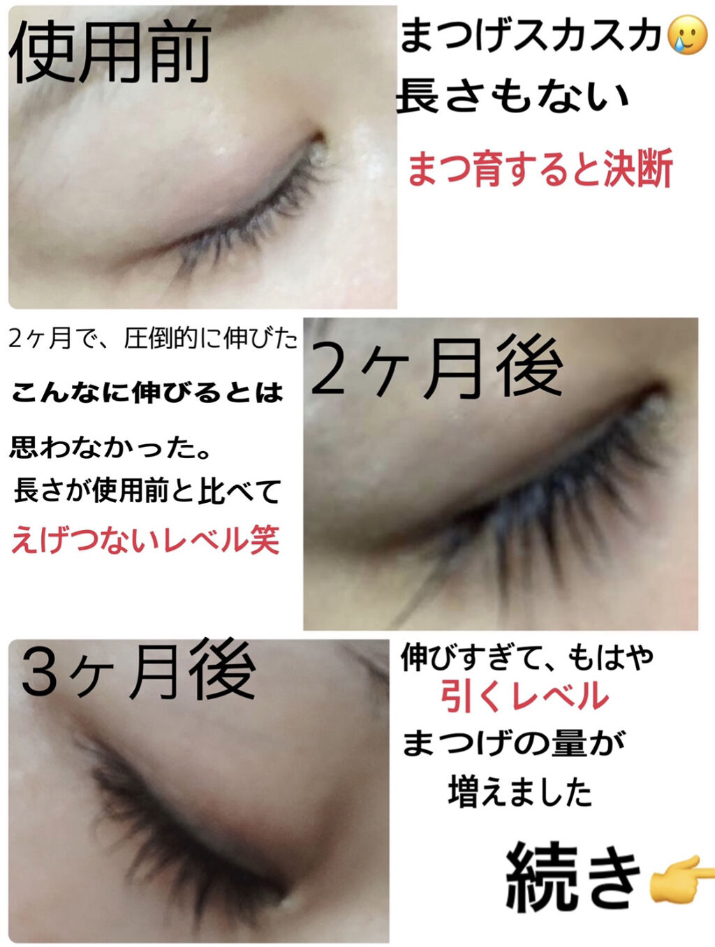 ラッシュアディクト　睫毛美容液さ 正規品】 まつ毛美容液 ラッシュアディクト 正規 アドバンス