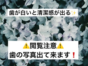 ⚠️ビフォーアフター写真あります❗️
⚠️歯のアップ写真です、閲覧注意です❗️

お金かけて良かった美容課金✨

歯のホワイトニングのお話。

ティオンホームプラチナという
ホームホワイトニングを
２週