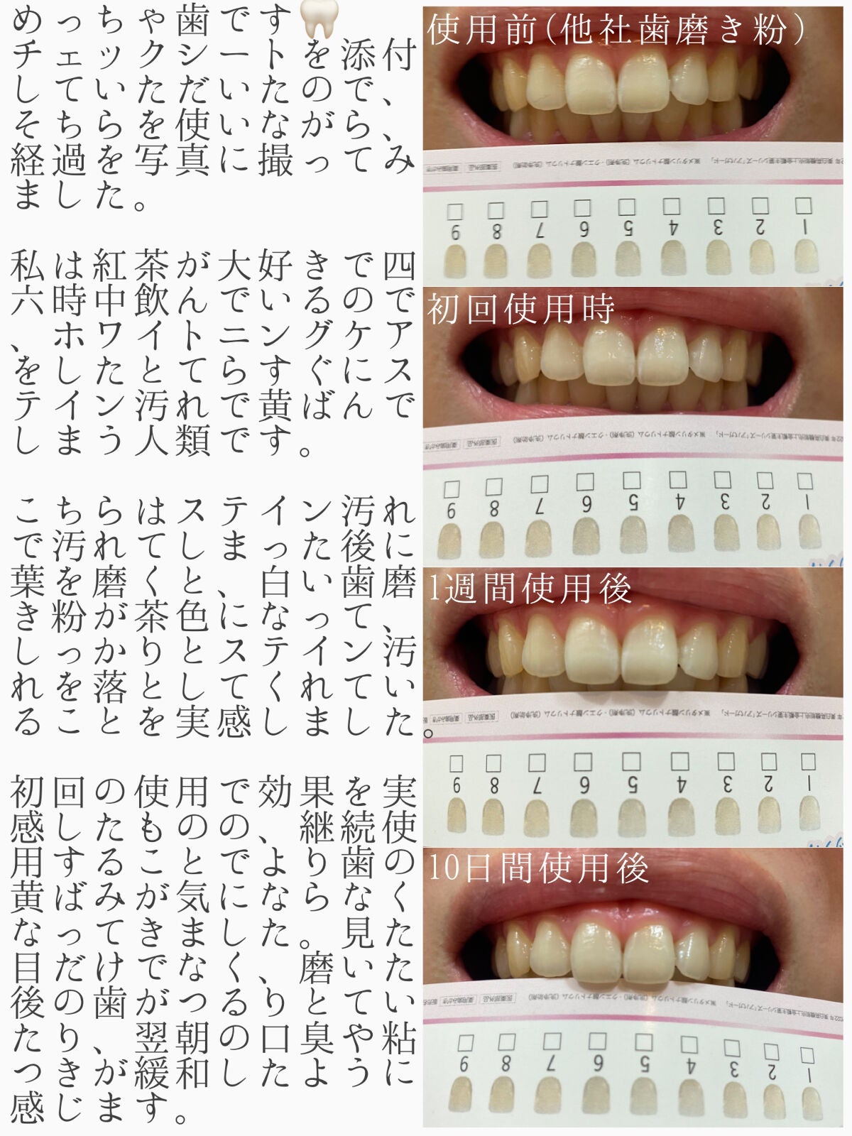 アパガードセレナ/アパガード/歯磨き粉を使ったクチコミ(2枚目)