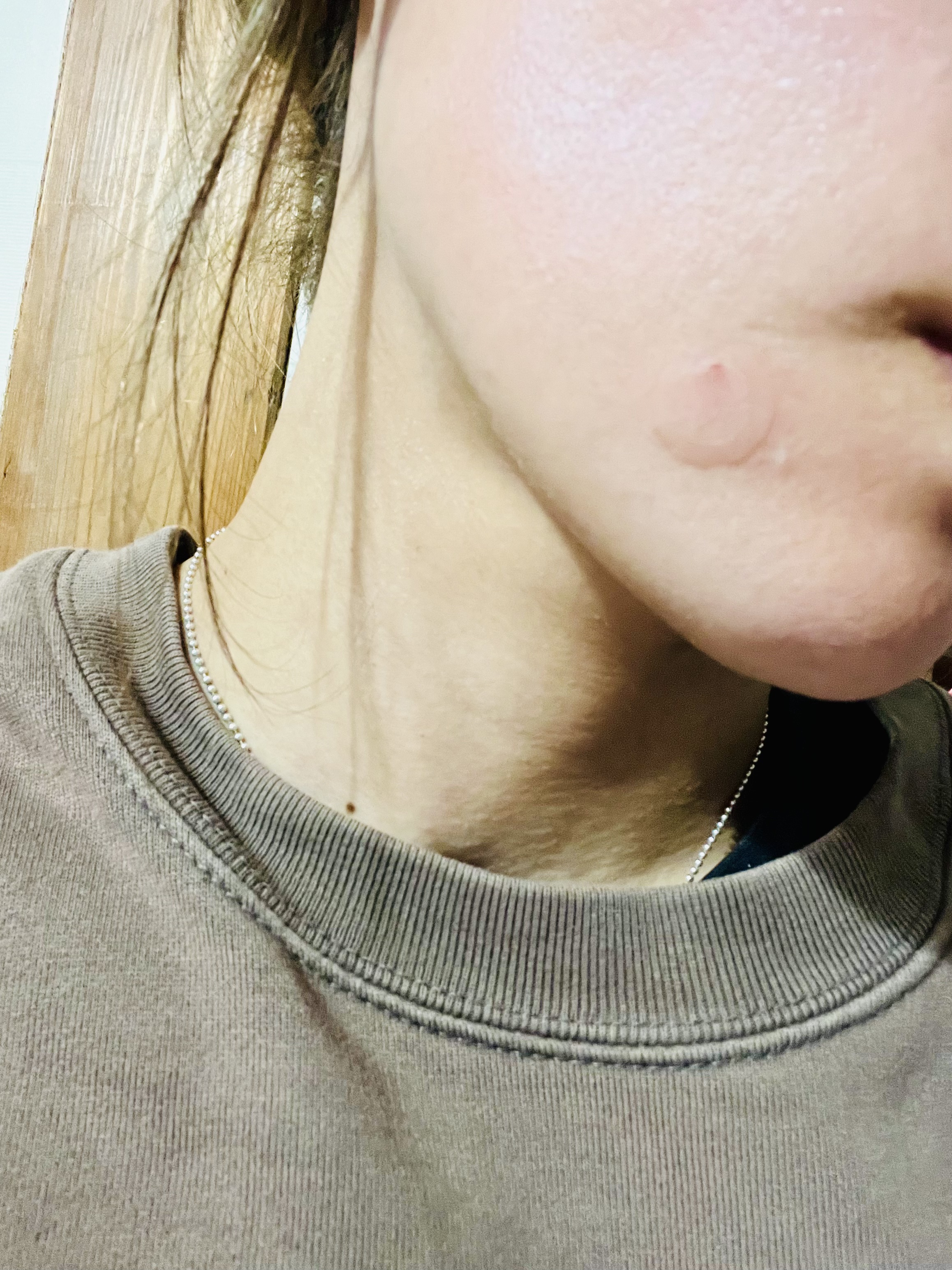 ビタミン レチノール リペア マイクロ スポット パッチ/BIOHEAL BOH/その他スキンケアを使ったクチコミ（2枚目）