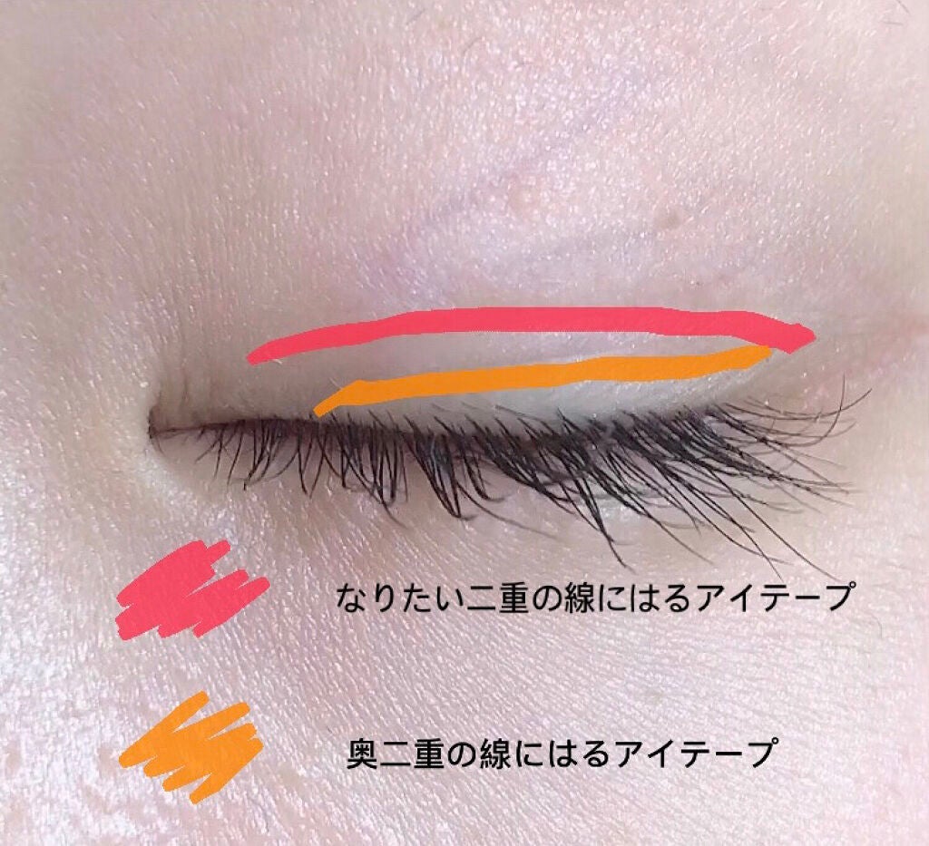 アイトーク/アイトーク/二重まぶた用アイテムを使ったクチコミ(4枚目)