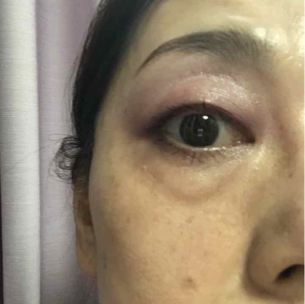 トレースレス タッチ ファンデーション SPF 45 サテンマット クッション コンパクト/TOM FORD BEAUTY/クッションファンデーションを使ったクチコミ（2枚目）