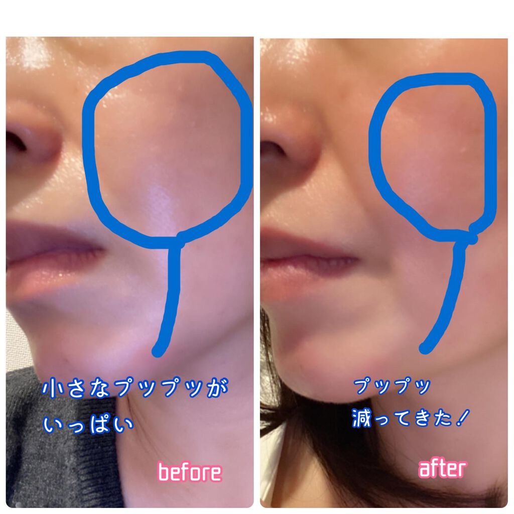 APRIAGEオイルS/AiB(エーアイビー)/ボディクリームを使ったクチコミ（3枚目）