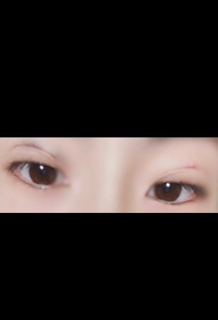 結友奈 on LIPS 「埋没永久保証埋没を決めたきっかけは圧倒的毎朝のアイプチのしんど..」(1枚目)