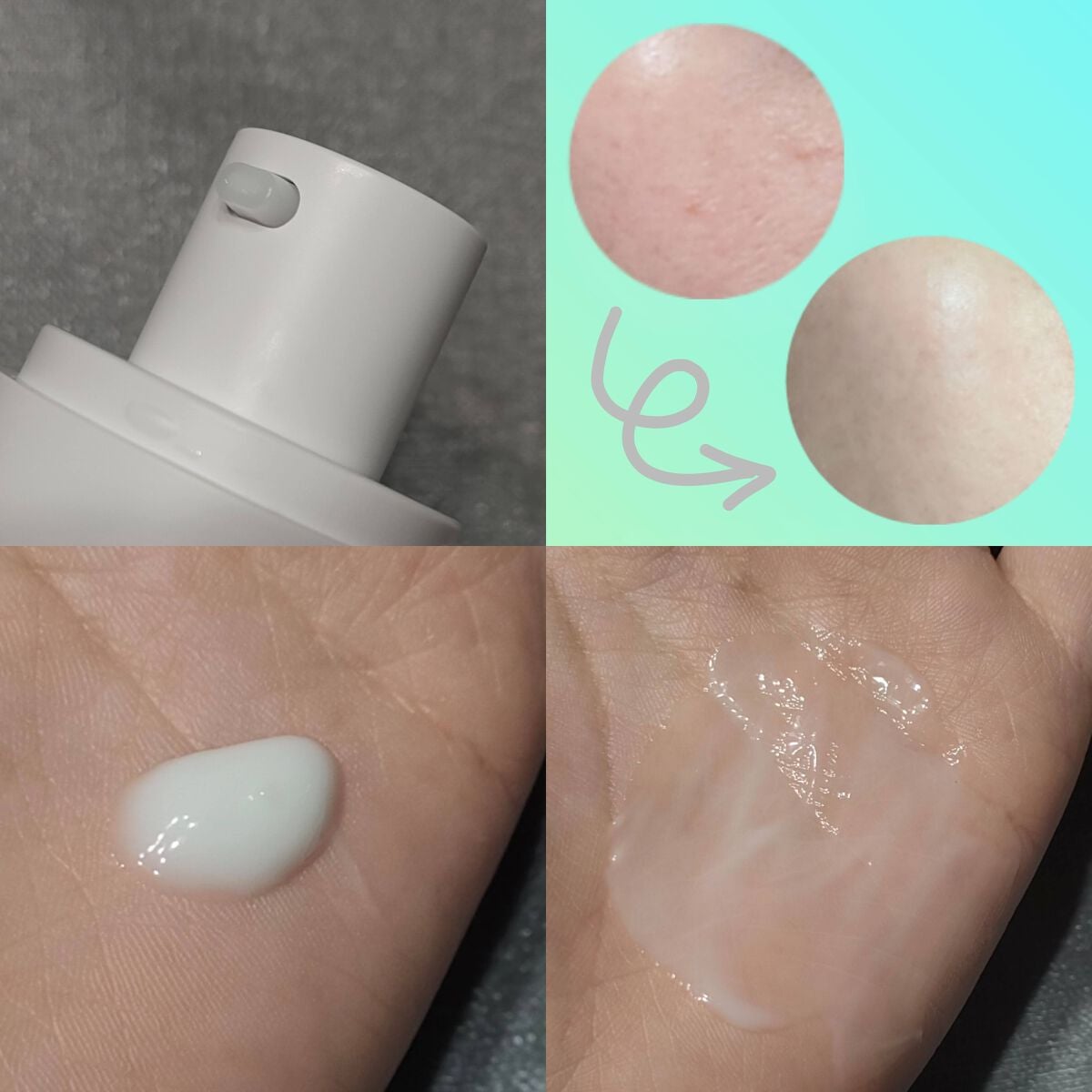 シカレチA エッセンス0.1/VT/美容液を使ったクチコミ(2枚目)